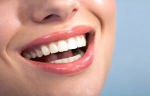 Woman Smiling After Teeth Whitening from Green Dental of Alexandria VA